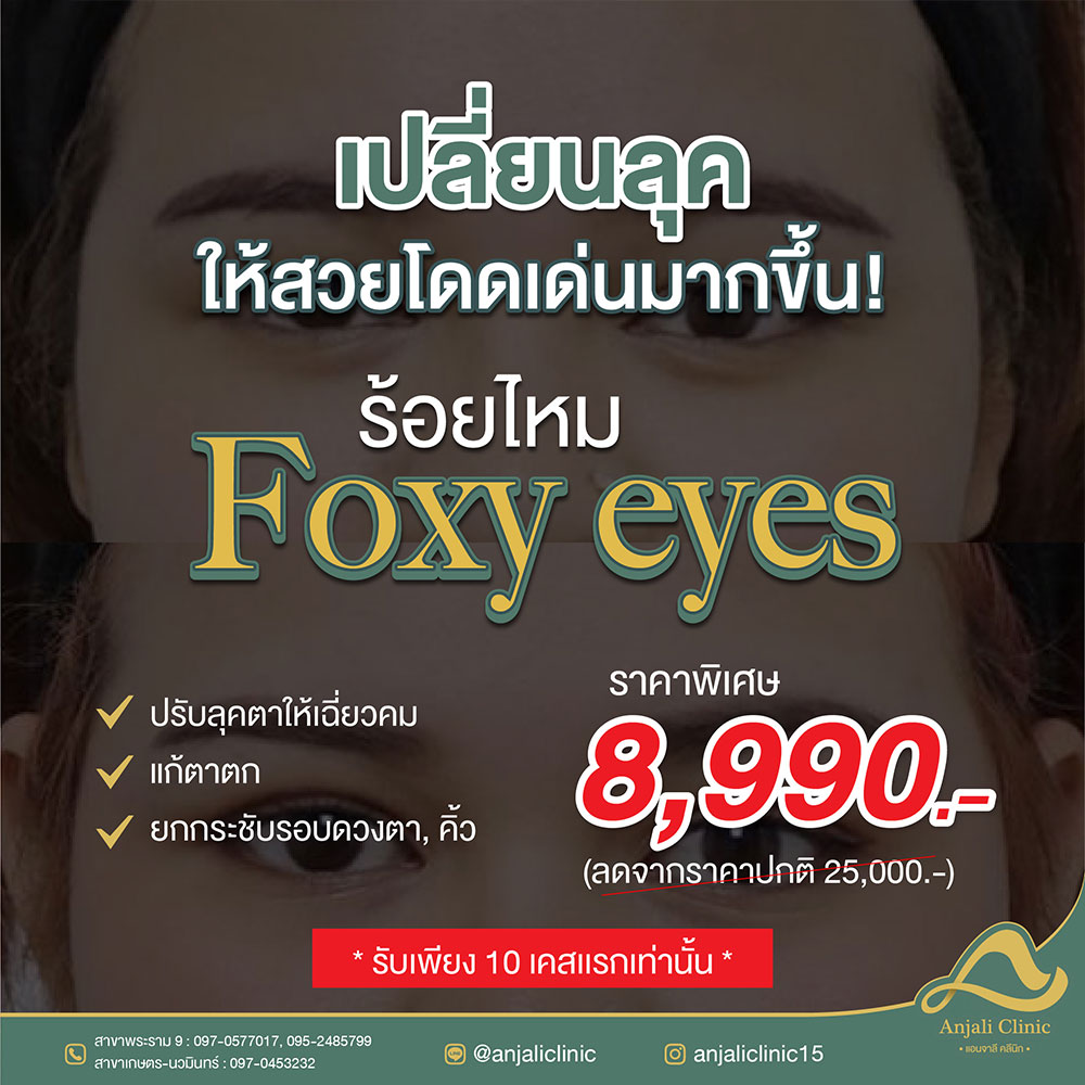 foxy-eye-8900